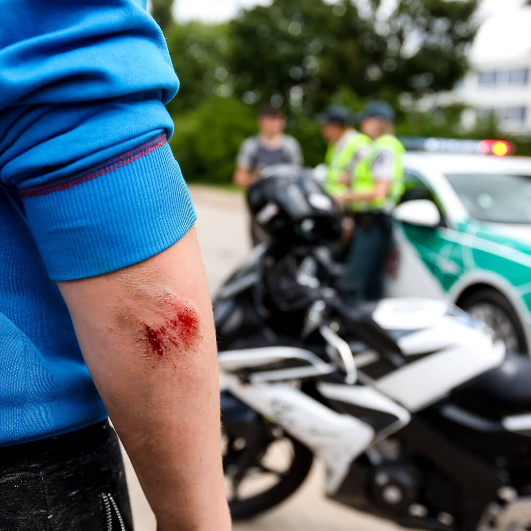 High Stakes Injury Law - Top-Rated Motorcycle Accident Lawyer in Las Vegas NV - Motorcycle Crash Claims